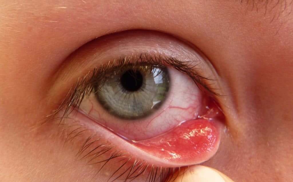 Enfermedades-oculares-o-de-los-ojos-1