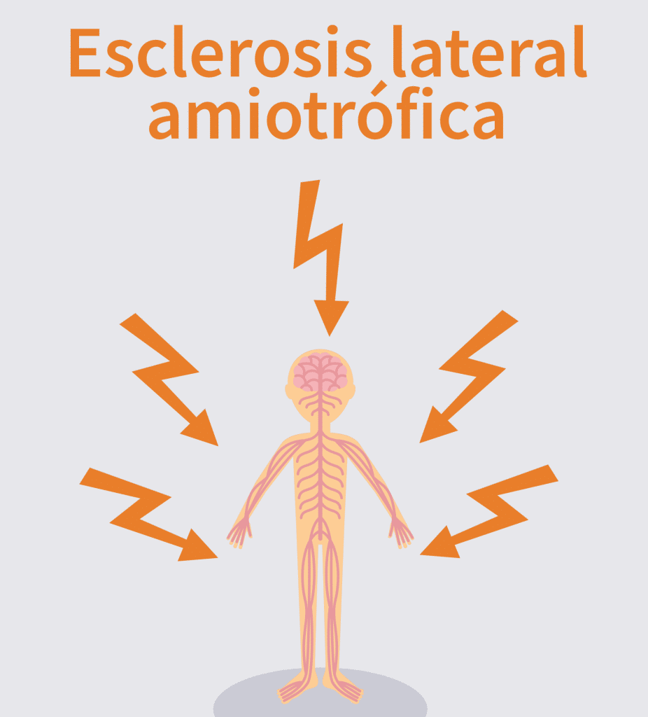 Esclerosis-lateral-amiotrófica 23