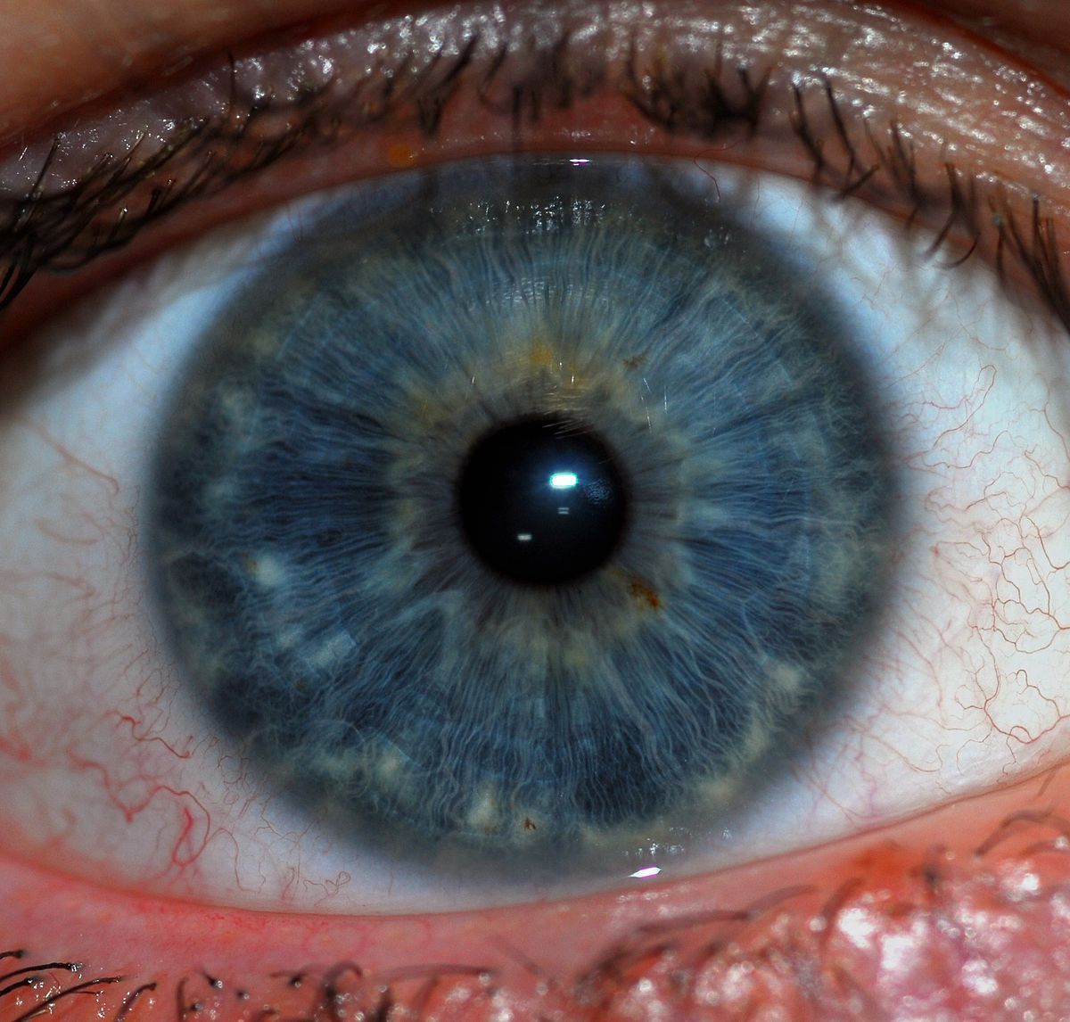 nervio-motor-ocular-externo4