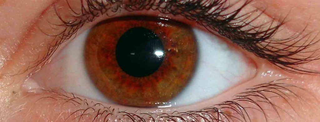 En la Distrofia retinal existen muchas otras enfermedades hereditarias