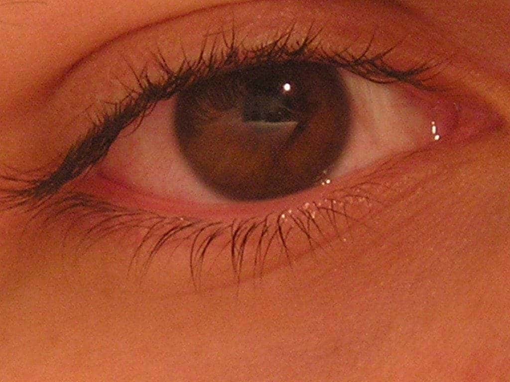 ojo rojo por dellen corneal