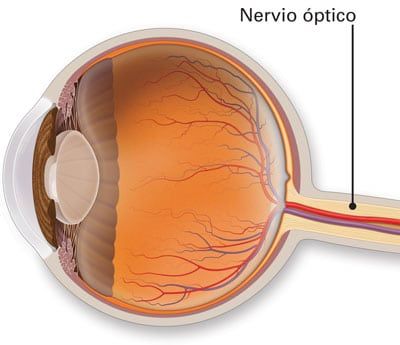 sindrome-oculoglandular- de-parinaud-3
