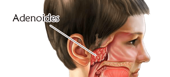 dolor de oido