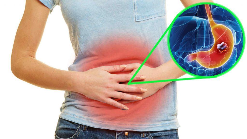causas de sintomas de cancer de estomago