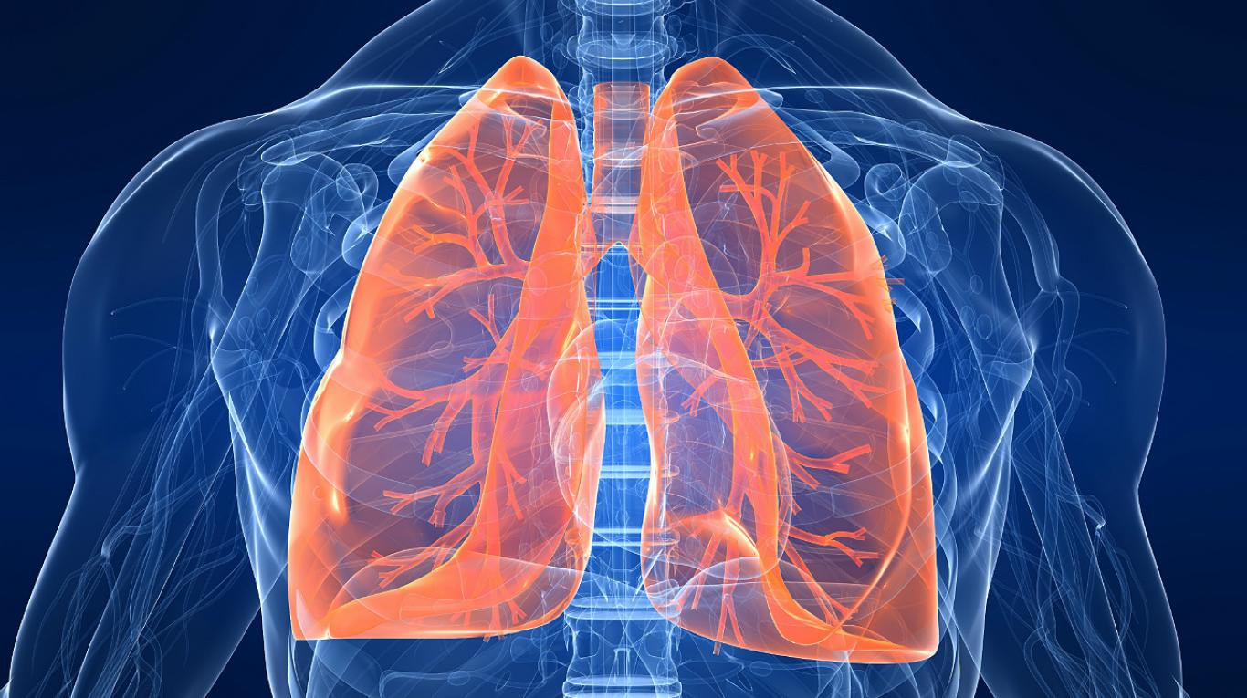 condensacion pulmonar