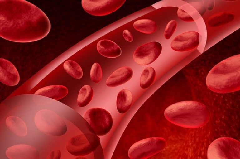 anemia hemolitica autoinmune
